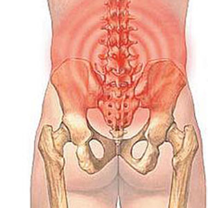 腰肌劳损都是由哪些原因造成的