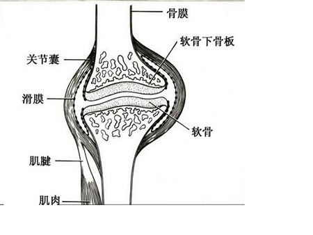 骨关节炎